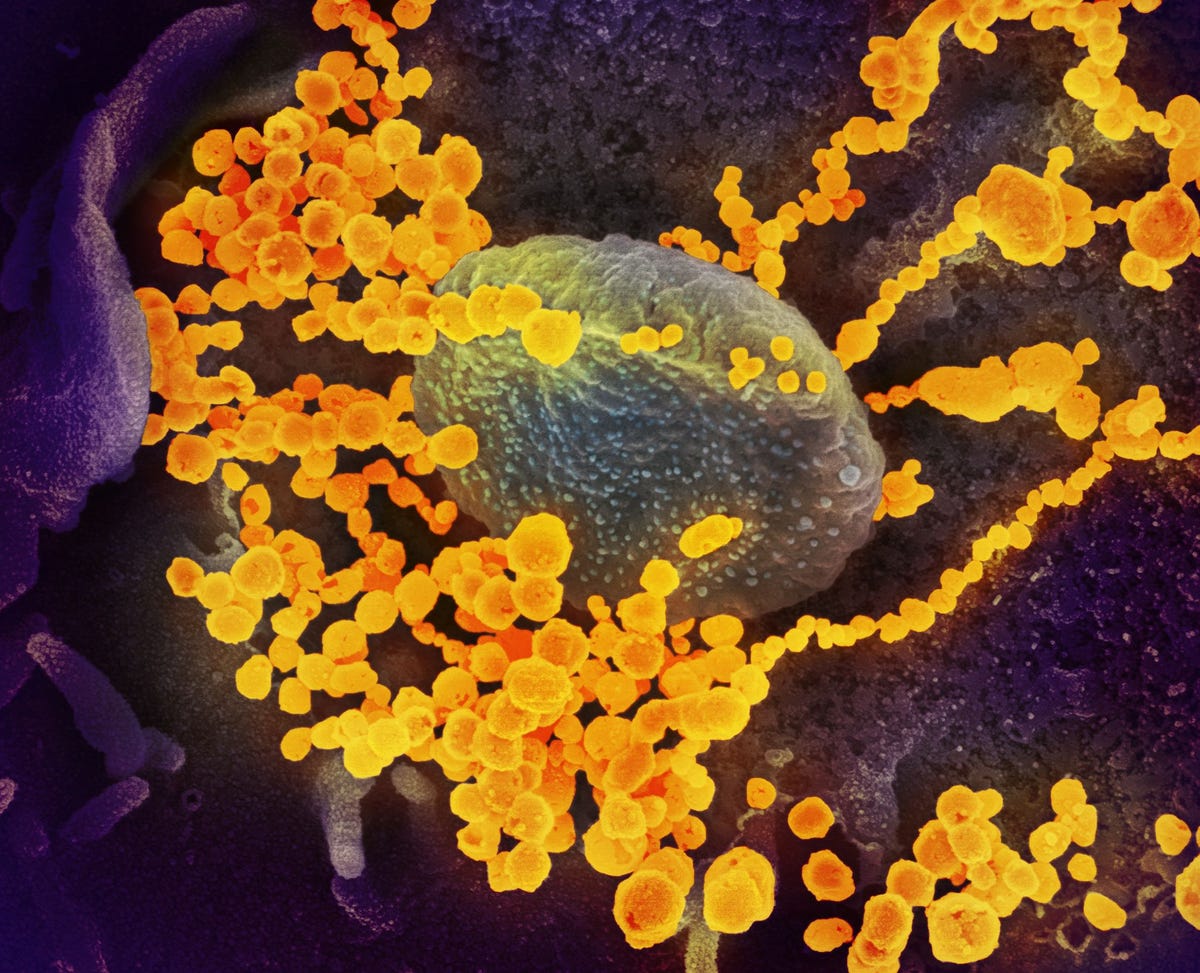 Op deze opname die gemaakt werd met een rasterelektronenmicroscoop is te zien hoe SARSCoV2 ronde goudkleurige objecten bevestigd is aan de oppervlakte van in het lab gekweekte cellen SARSCoV2 is het virus dat COVID19 veroorzaakt