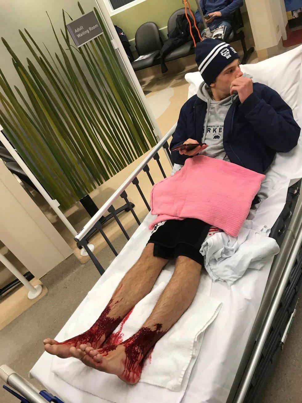 Tiener Sam Kanizay ligt met zijn bloedende voeten in een bed Een tiener die ging zwemmen bij een strand bij Melbourne en terugkwam met zijn voeten onder het bloed stelt zeeexperts voor een raadsel