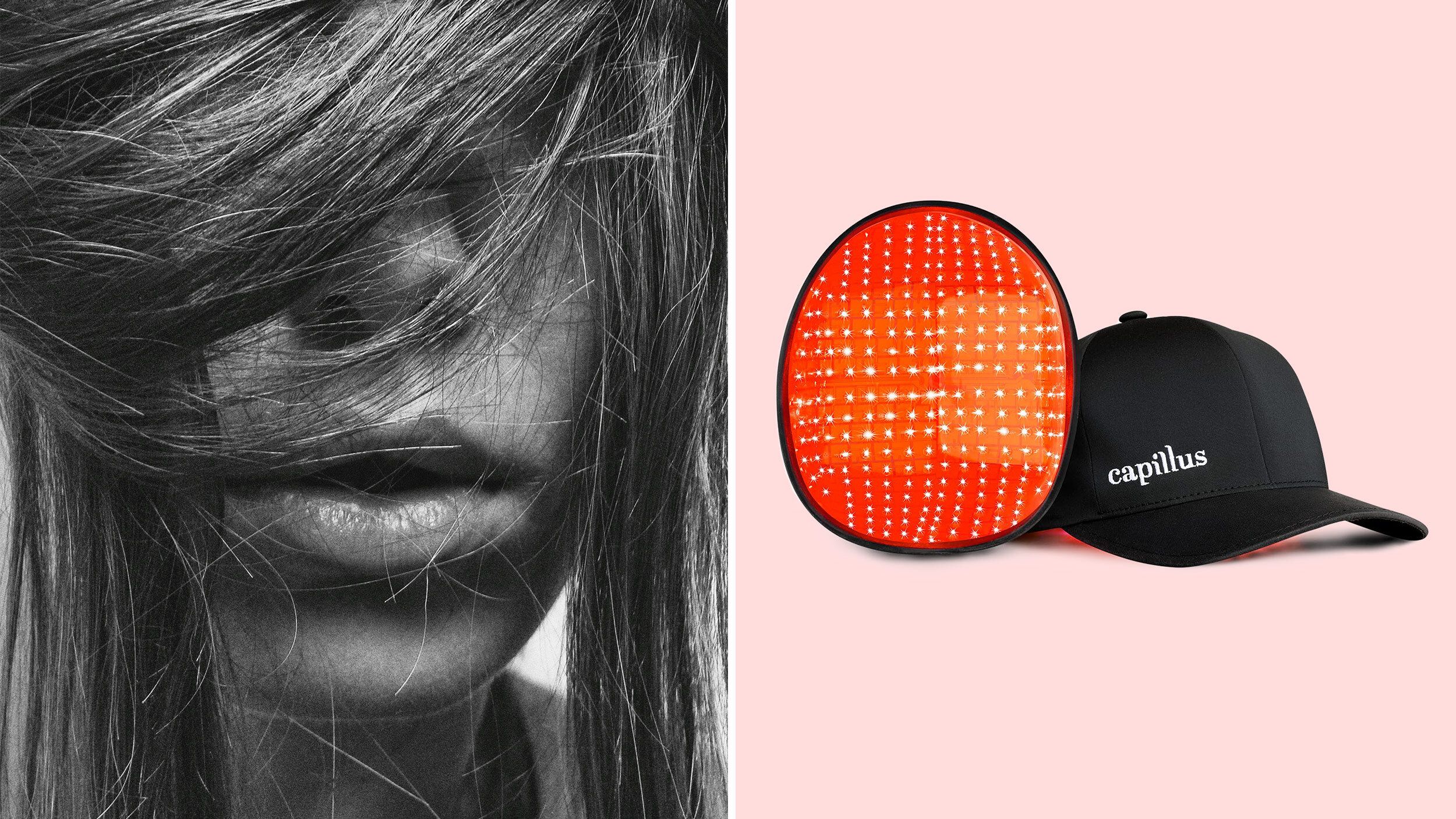 Red Light Therapy Is the Next Big Thing for Hair Loss