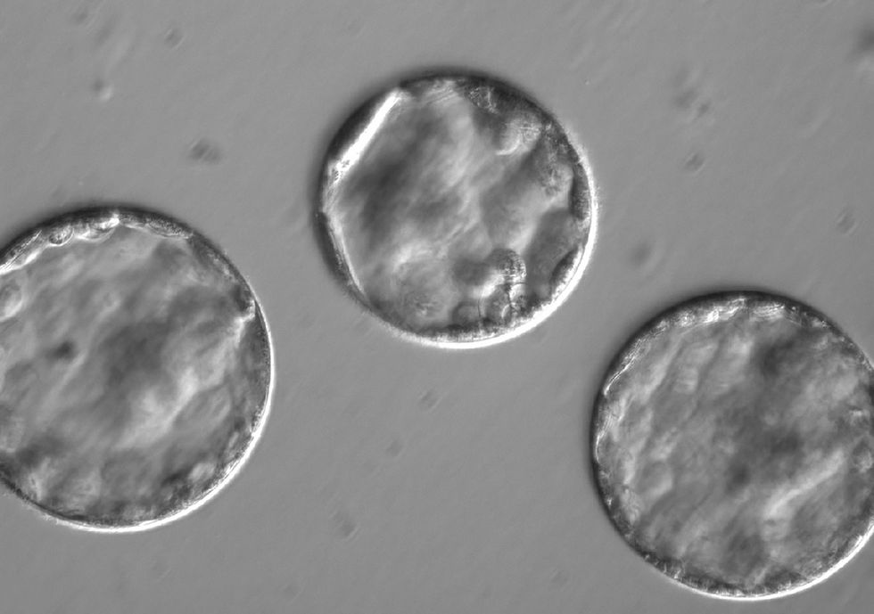 Twee dagen nadat ze werden genjecteerd met een enzym voor genbewerking was uit deze groeiende menselijke embryos een ziekteverwekkende mutatie verwijderd