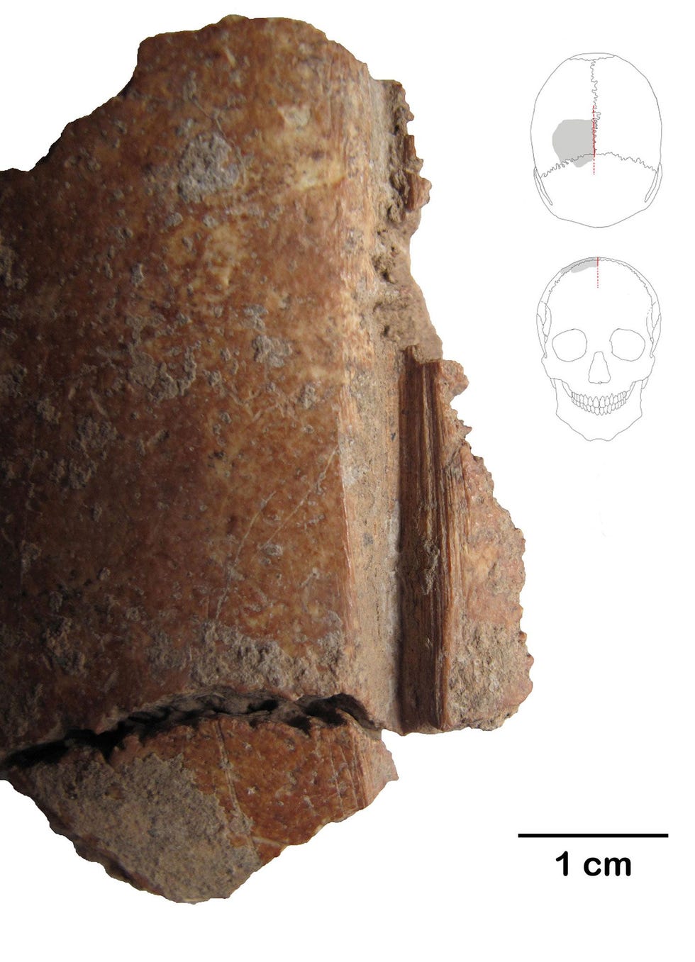 Dit schedelfragment vertoont een diepe inkeping die 10000 jaar geleden met een vuurstenen werktuig is gemaakt