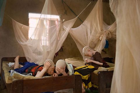 In het Kabangacentrum in Tanzania moeten Melas Luge 10 en zijn zusjes Zawia 11 en Shamima Kassimu voorwerpen dichtbij hun gezicht houden om ze te kunnen zien Mensen met albinisme hebben slechte ogen wat vaak verholpen kan worden door een bril Ze doen het goed op school door in de voorste bankjes te zitten en aantekeningen te delen met klasgenoten