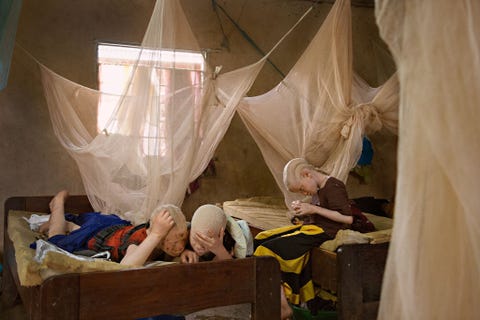 https://www.nationalgeographic.com/content/dam/photography/rights-exempt/most-moving-photos-2017/06-moving-2017albinism-albinos-children-tanzania-vision.jpg In het Kabangacentrum in Tanzania moeten Melas Luge 10 en zijn zusjes Zawia 11 en Shamima Kassimu voorwerpen dichtbij hun gezicht houden om ze te kunnen zien Mensen met albinisme hebben slechte ogen wat vaak verholpen kan worden door een bril Ze doen het goed op school door in de voorste bankjes te zitten en aantekeningen te delen met klasgenoten