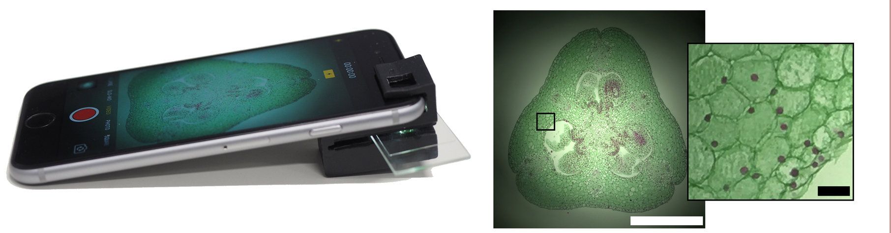 Diple Turns Your Smartphone into a Powerful Microscope