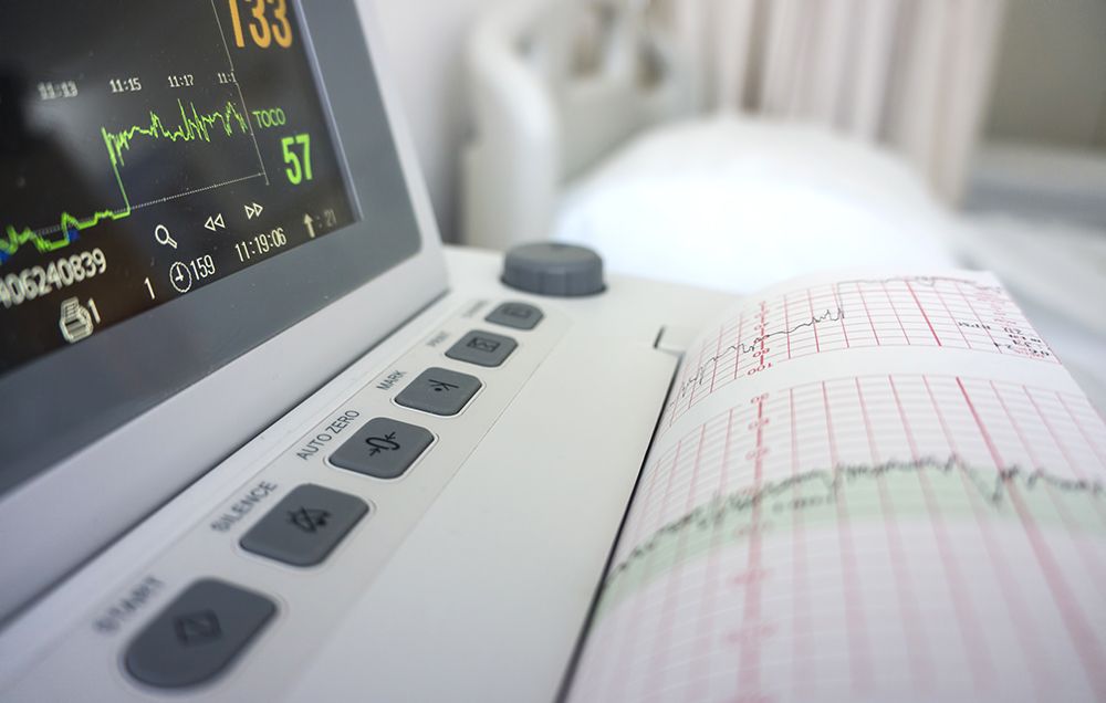 Changes in heart rate