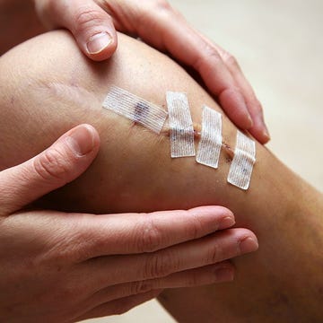 ACL Surgury ACL Surgury