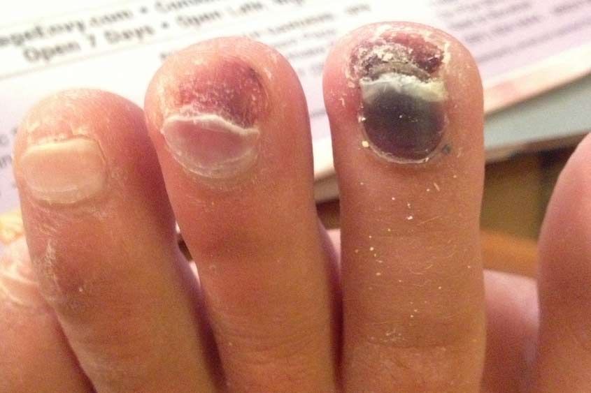 Gel Nails on Toes - Good, Bad, or Ugly?