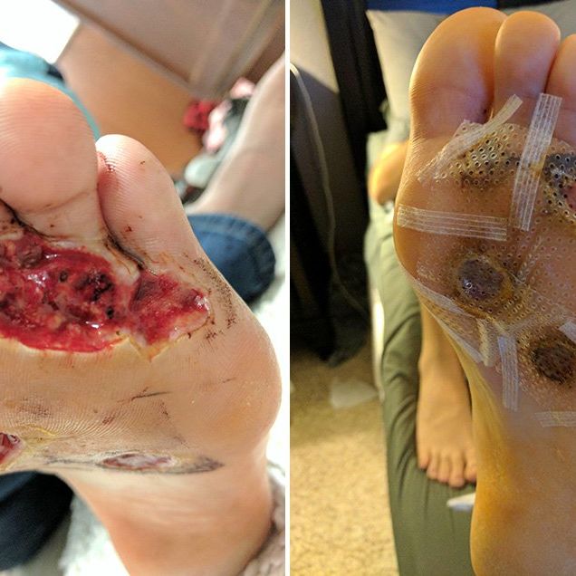 man foot fungus barefoot shower at gym