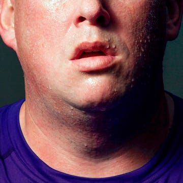 overweight and cancer relations overweight and cancer relations