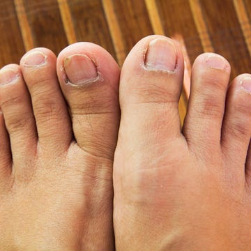 Toenail health