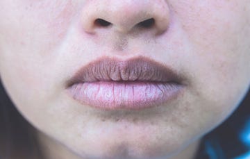 close up of woman with chapped lips