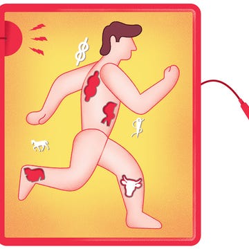 treating runner muscle cramps treating runner muscle cramps