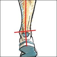 media pronation, explained