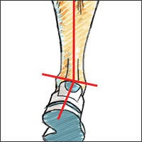 media supination, explained