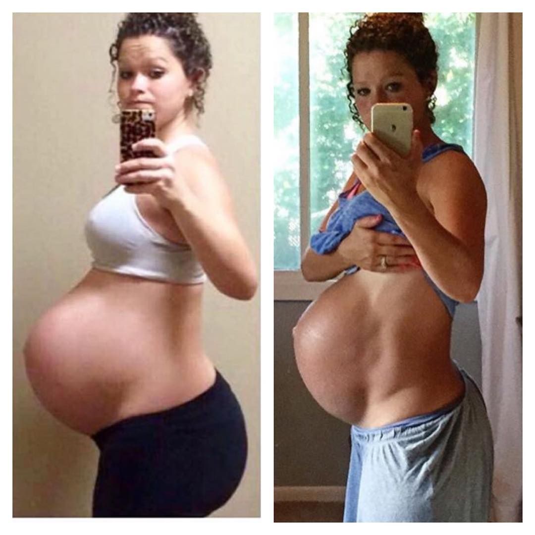 грудь стала мягкой 19 недель беременности фото 43
