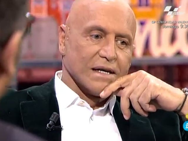 kiko matamoros, lifting facial