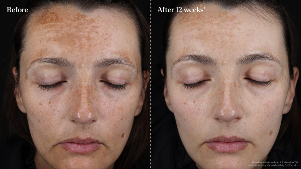 caroline hirons pigmentation serum