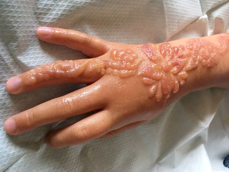 Skin, Hand, Nail, Finger, Design, Peach, Flesh, Wrist, Mehndi, Pattern, 
