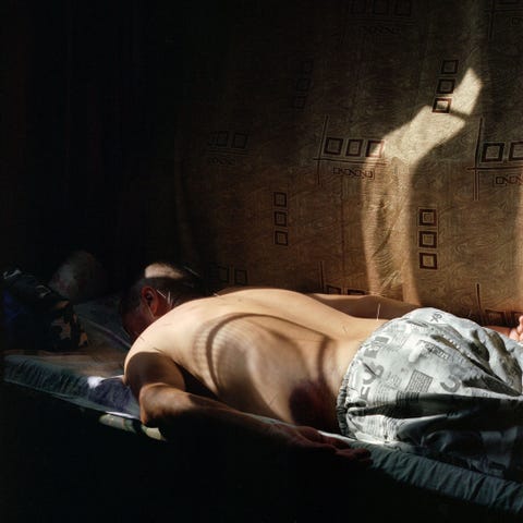 In een tijdelijke kliniek die in Oesjtobe is opgezet door KoreaansAmerikaanse missionarissen ondergaat een Kazach een acupunctuurbehandeling