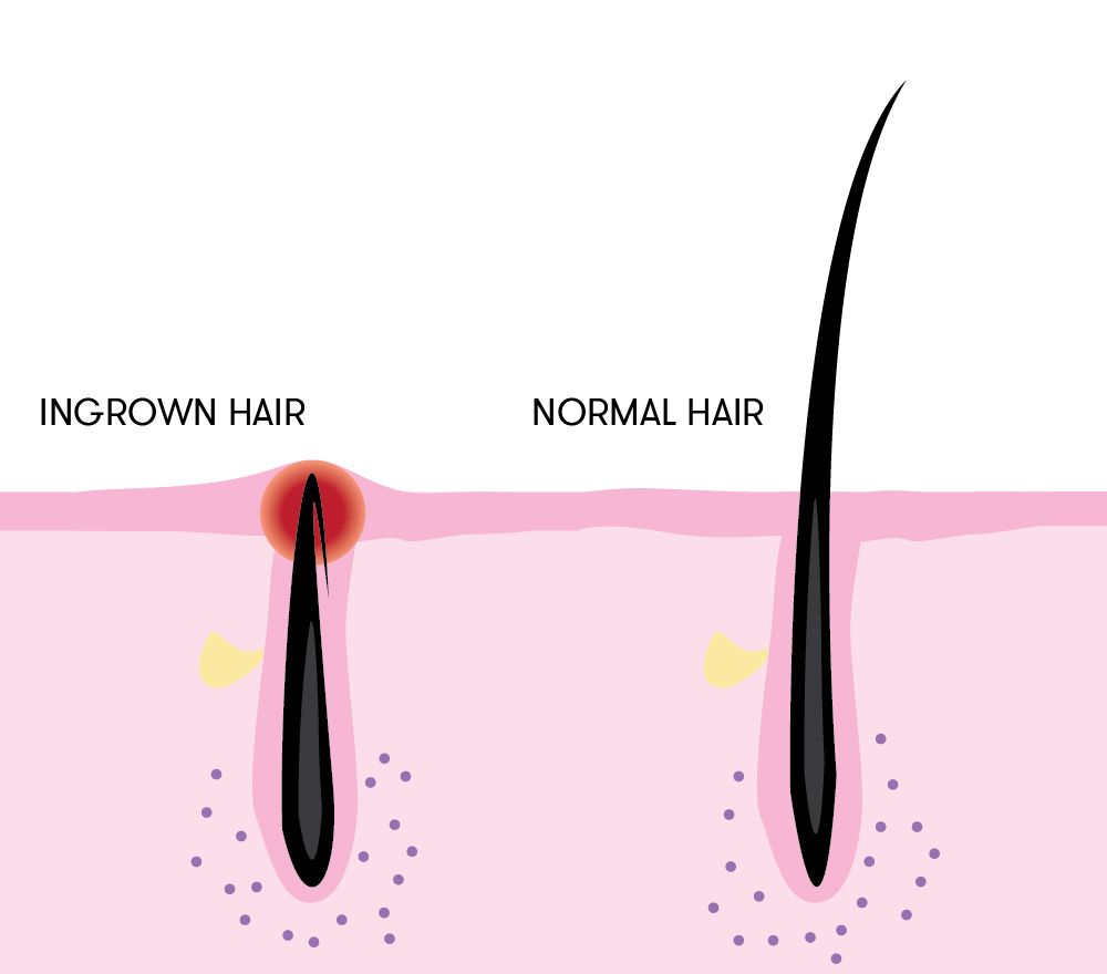 Hair Follicle Biology : Stemson Therapeutics
