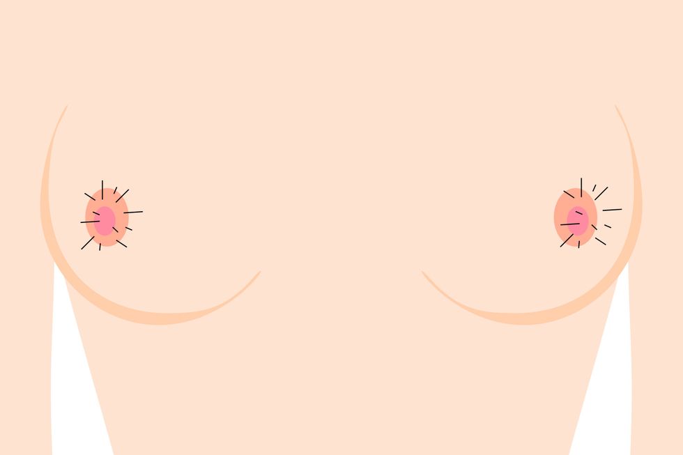 Nipple Symptoms - Are My Nipples Normal
