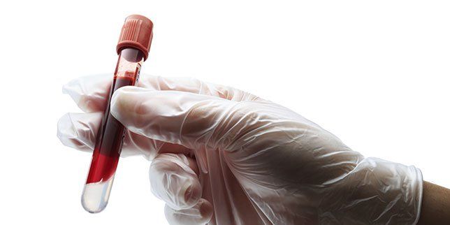 6 Essential Blood Tests You Should Have