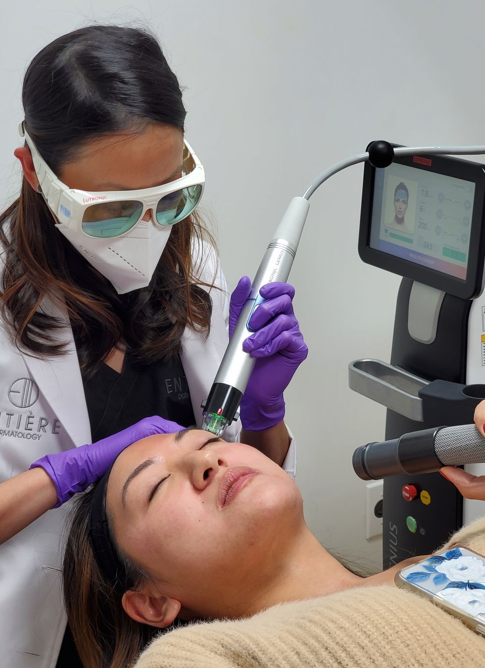 radiofrequency microneedling for acne scars