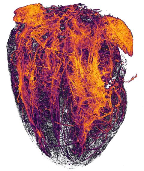 Deze foto van feloranje slierten gemaakt door onderzoekers van het Universittsklinikum Essen toont de bloedvaten van een muizenhart nadat het diertje een infarct heeft gehad