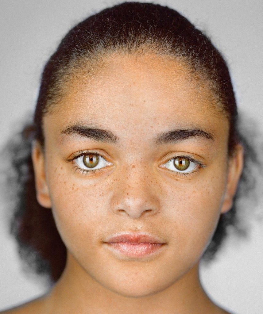Imani Cornelius 13 jaar uit Shakopee Minnesota ZelfID zwart en wit  Volkstellingsvakje aangekruist zwart  Imani heeft een beenmergtransplantatie nodig maar er is een tekort aan AfrikaansAmerikaanse en multiraciale donoren waardoor ze nu al twee jaar wacht omdat een goede match makkelijker gaat met iemand met dezelfde voorouders