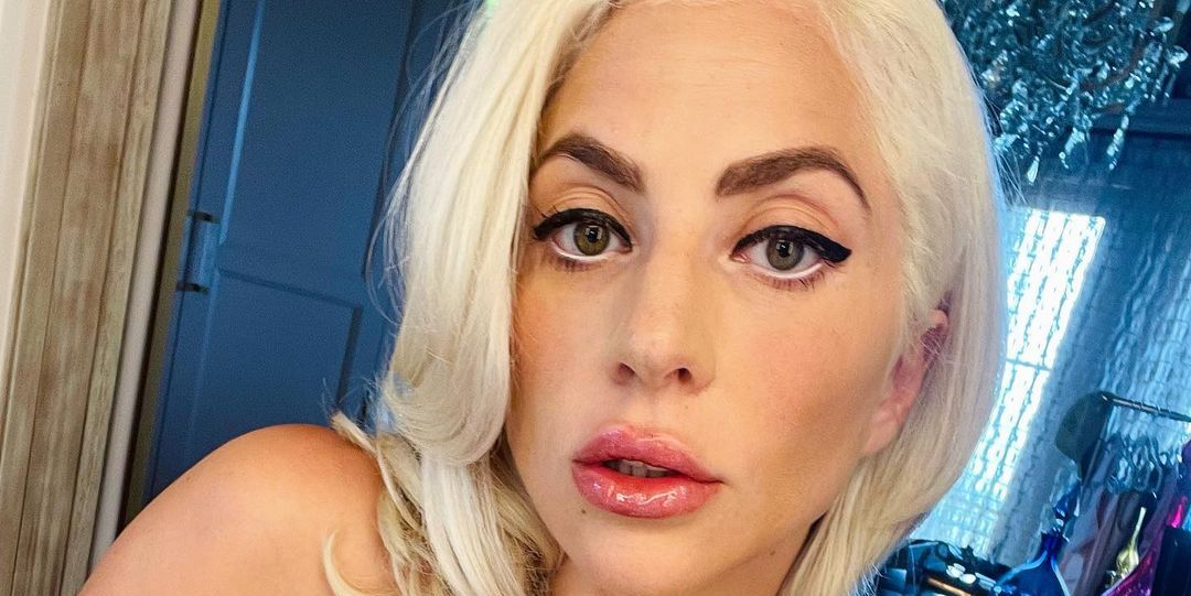 Lady Gaga, impacto, nueva boca y dientes, irreconocible