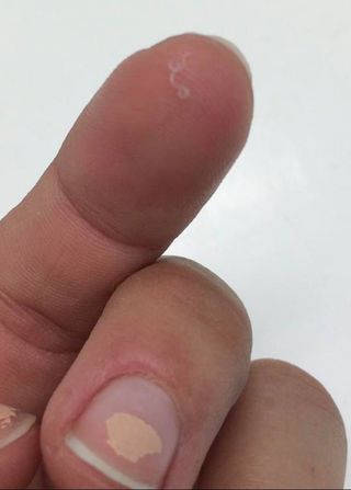 An eyeworm on Abby Beckley's finger