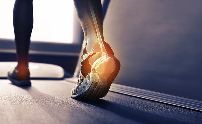 Foot & Ankle Injury Treatment | Rockwall Foot & Ankle Specialist