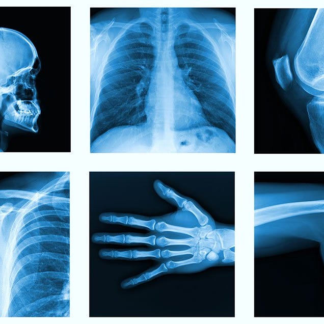 What To Eat For Stronger Bones