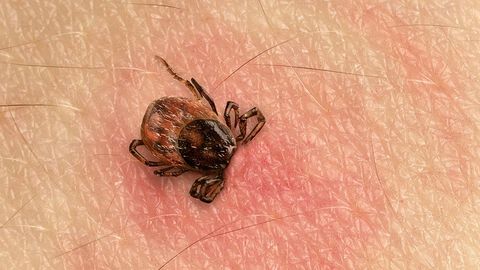 preview for How to Prevent and Take Care of Tick Bites