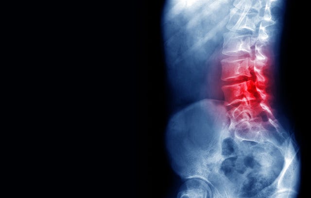 Signs your back pain may be something more serious