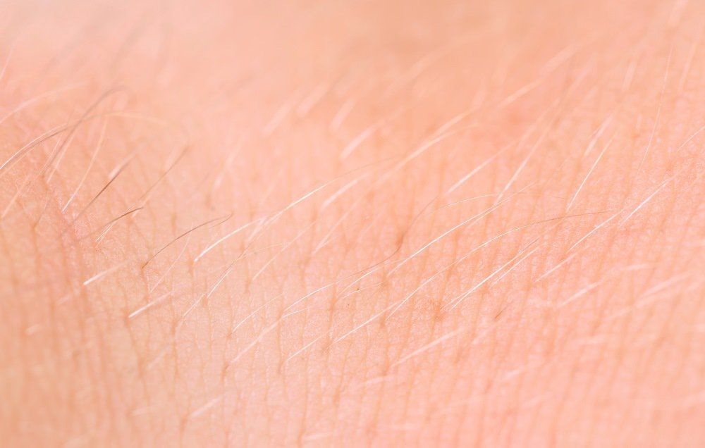 Excessive or unwanted hair in women Causes and natural treatments