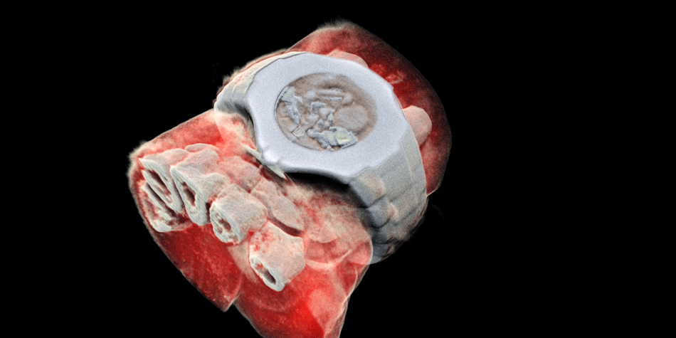 See Bones, Blood and Tissue in World's First 3D Colored X-Ray