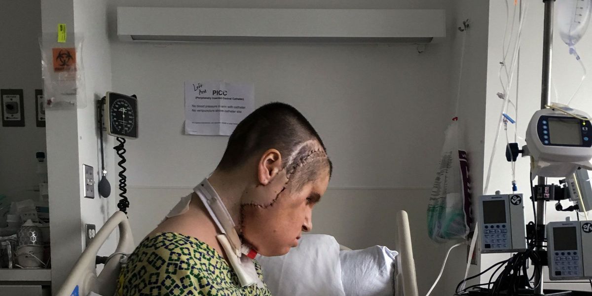 Op de intensive careafdeling van de Cleveland Clinic heeft Katie Stubblefield een moment voor haarzelf Drie weken na haar 31 uur durende gezichtstransplantatie zijn de hechtingen nog te zien en is haar gezicht nog altijd opgezwollen