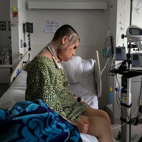 Op de intensive careafdeling van de Cleveland Clinic heeft Katie Stubblefield een moment voor haarzelf Drie weken na haar 31 uur durende gezichtstransplantatie zijn de hechtingen nog te zien en is haar gezicht nog altijd opgezwollen