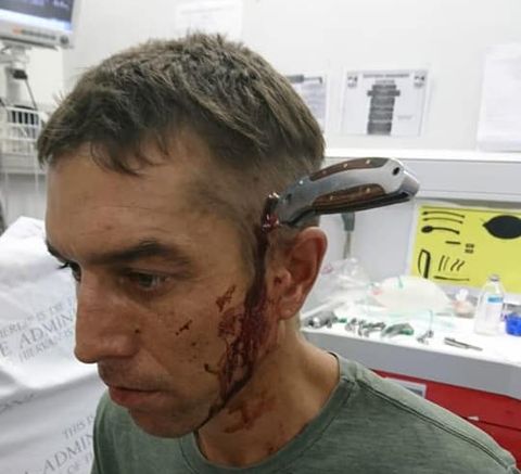 Cyclist Knife in Head
