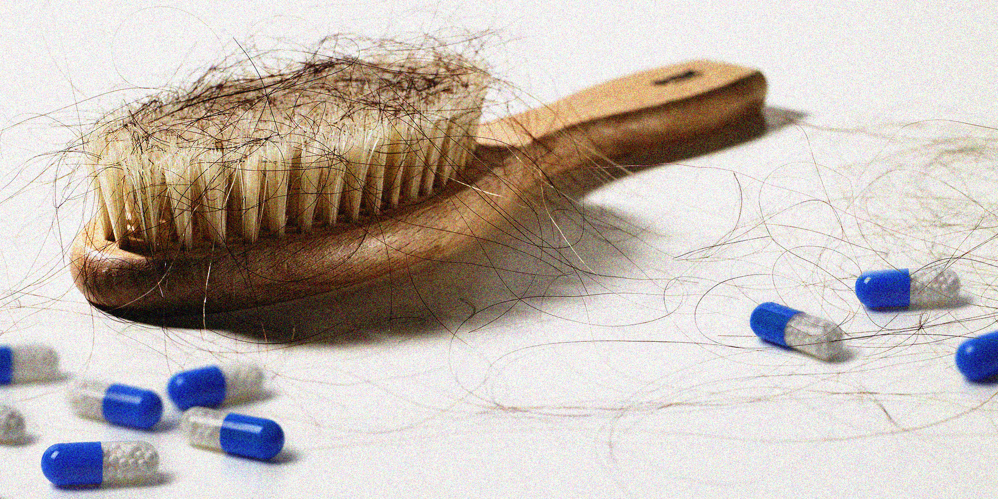 Biotin for Hair Growth - Does Biotin Really Work to Prevent Hair Loss