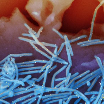 Een elektronenmicroscopische afbeelding van het respiratoir syncytieel virus RSV De virusdeeltjes blauw zijn gebonden aan met goud gelabelde antiRSVFeiwitantilichamen geel die van het oppervlak van menselijke longcellen afkomen Het aantal gevallen van RSV neemt dit jaar ongebruikelijk vroeg toe