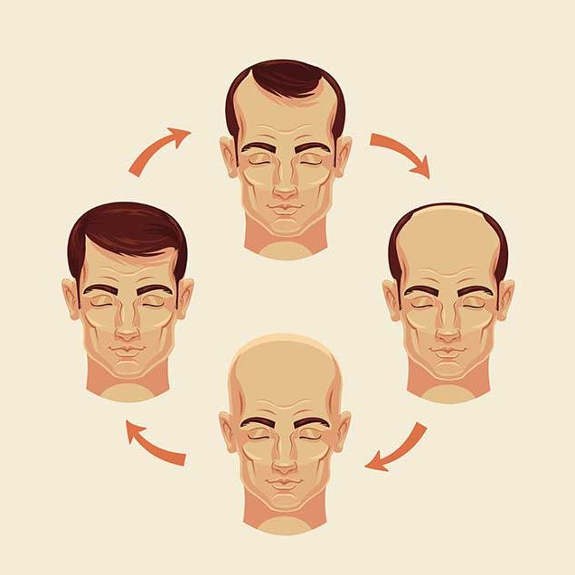 What You Need to Know About Hair Loss | Men's Health