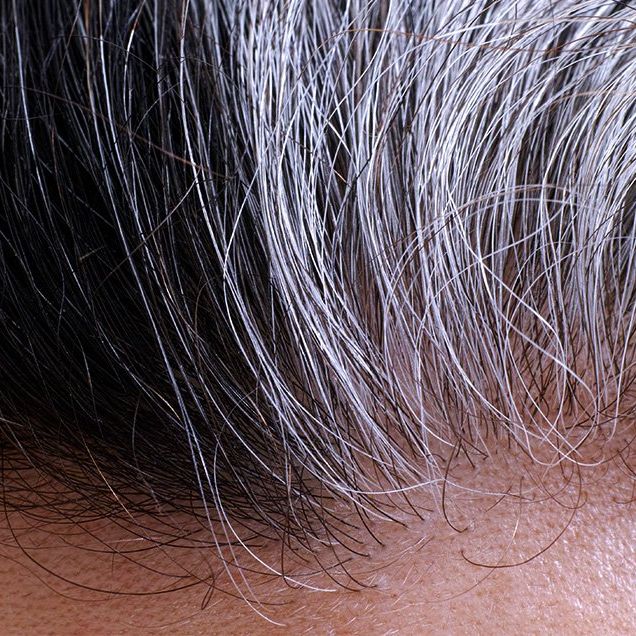 hair going gray 