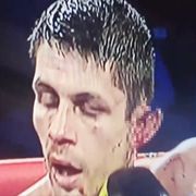 boxer's ear ripped off in ring