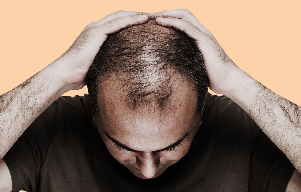 end balding and greying