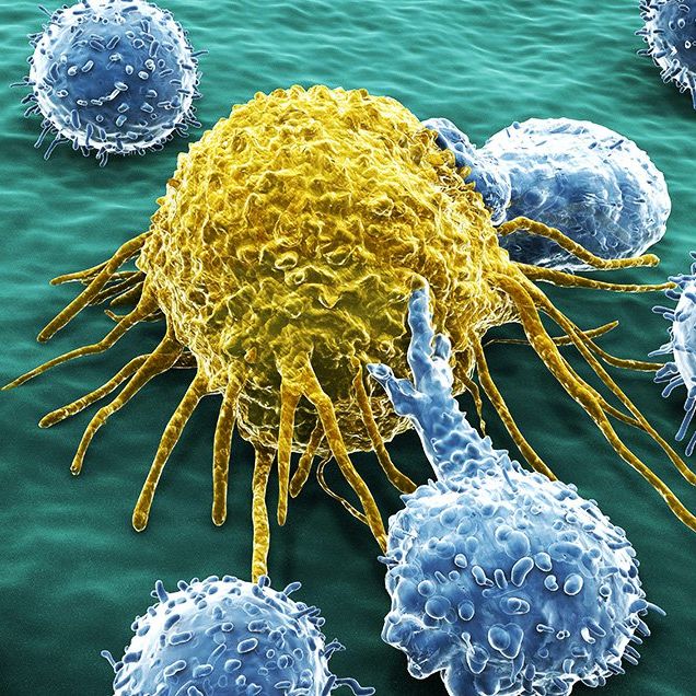foods might stop cancer from spreading