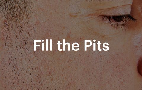 fill the pits