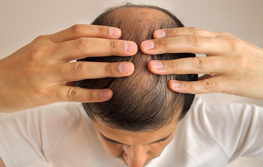 Hair Loss Linked to Late Summer and Early Fall | Men's Health