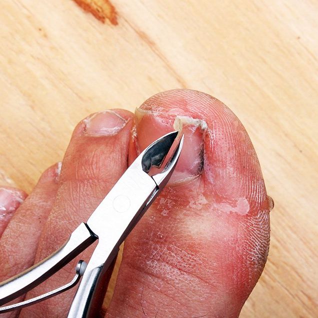 CUTTING AND TRIMMING SUPER THICK TOENAILS!!! ***HOW TO MANAGE HARD